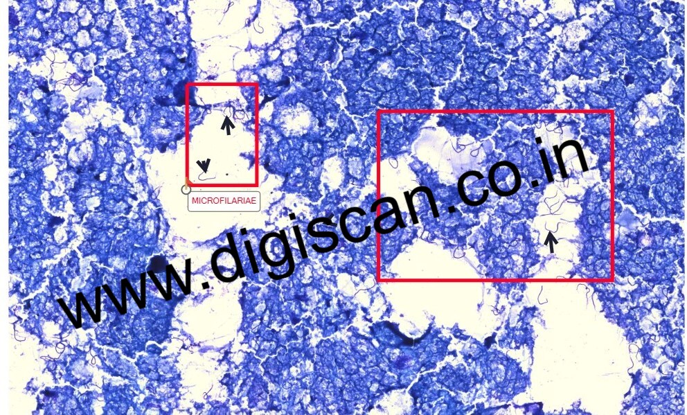 Microbiology & Parasitology Digital Slides Set (Microbial & Parasitic Diseases)